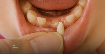 674159168 4411289179107314 7381754800922913091 n