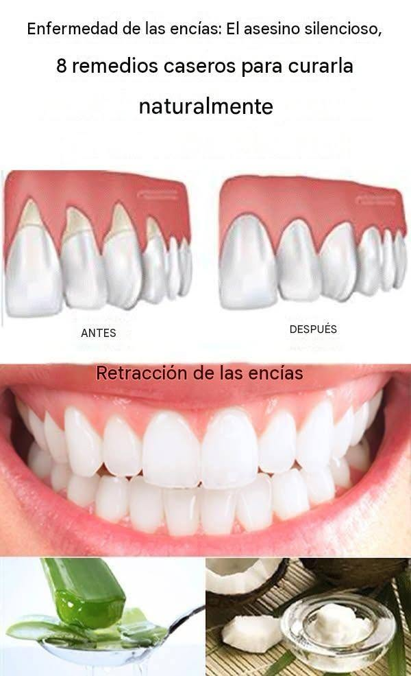 EUyVYS3